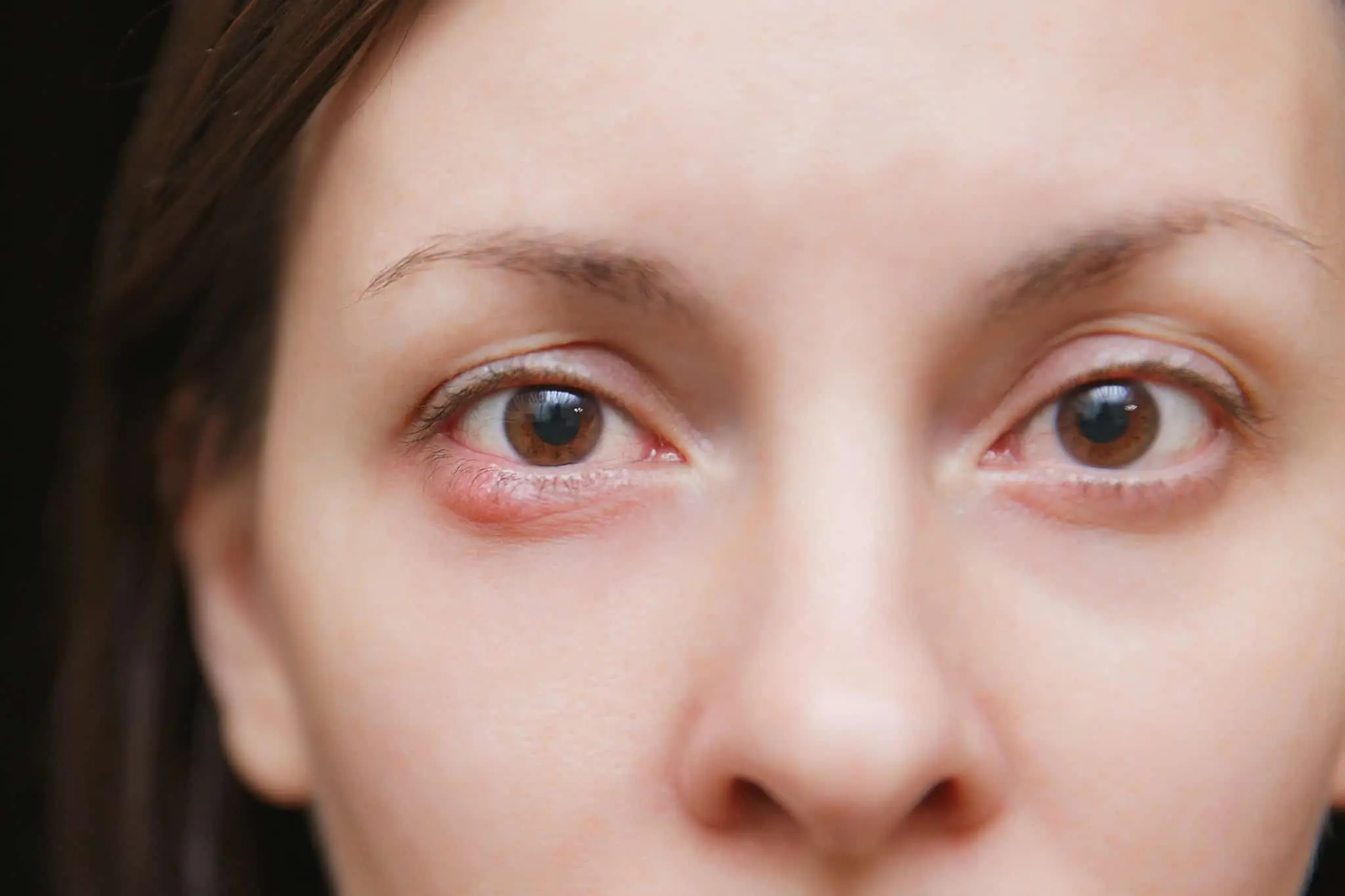 بهترین درمان رتینوپاتی چشم کدام است؟