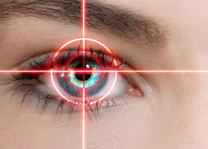 عمل لازک چشم چیست ؟