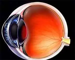 انواع ویترکتومی چشم