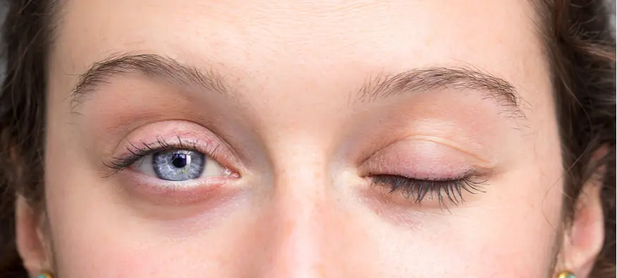 تقویت بینایی در طب سنتی