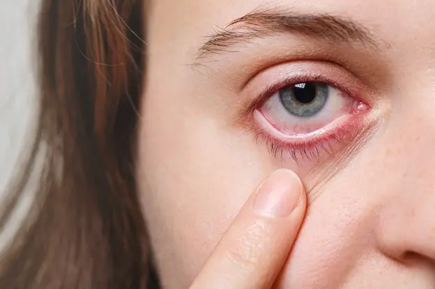 دلایل ایجاد لکه خونی درون چشم چیست
