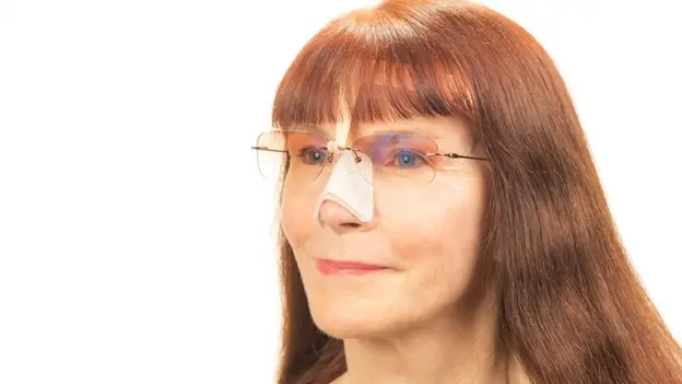 استفاده از عینک بعد عمل بینی